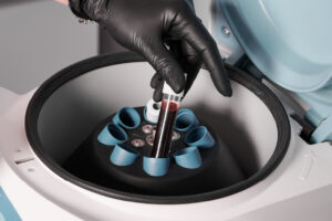 Investigadores UFRO obtienen fondos ANID para adquirir equipamiento científico de vanguardia